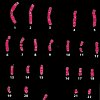caryotypes_ovule